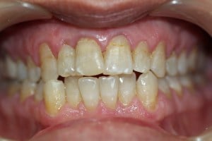 Smile with yellow teeth
