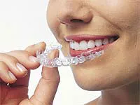 Woman holding an Invisalign Tray